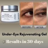 Undereye Rejuvenating Gel